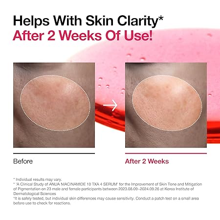 Anua - Niacinamide 10 + TXA 4 Serum